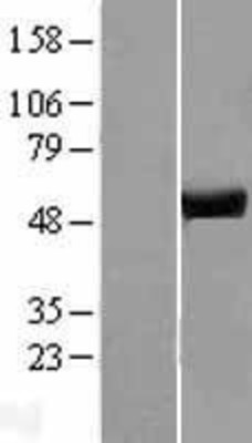 Western Blot: ATP6V1H Overexpression Lysate (Adult Normal) [NBP2-10133] Left-Empty vector transfected control cell lysate (HEK293 cell lysate); Right -Over-expression Lysate for ATP6V1H.