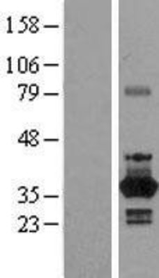 Western Blot: NEK6 Overexpression Lysate (Adult Normal) [NBP2-10193] Left-Empty vector transfected control cell lysate (HEK293 cell lysate); Right -Over-expression Lysate for NEK6.
