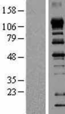 Western Blot: eIF4ENIF1 Overexpression Lysate (Adult Normal) [NBP2-10221] Left-Empty vector transfected control cell lysate (HEK293 cell lysate); Right -Over-expression Lysate for eIF4ENIF1.