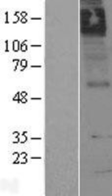 Western Blot: Muscarinic Acetylcholine Receptor M5 Overexpression Lysate (Adult Normal) [NBL1-09177] Left-Empty vector transfected control cell lysate (HEK293 cell lysate); Right -Over-expression Lysate for Muscarinic Acetylcholine Receptor M5.