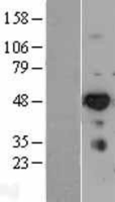 Western Blot: IRF6 Overexpression Lysate (Adult Normal) [NBL1-12036] Left-Empty vector transfected control cell lysate (HEK293 cell lysate); Right -Over-expression Lysate for IRF6.