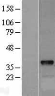 Western Blot: DOK5 Overexpression Lysate (Adult Normal) [NBL1-09980] Left-Empty vector transfected control cell lysate (HEK293 cell lysate); Right -Over-expression Lysate for DOK5.