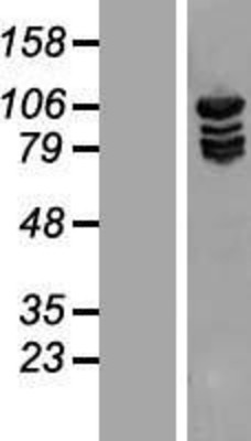 Western Blot: Methionyl tRNA synthetase Overexpression Lysate (Adult Normal) [NBL1-12901] Left-Empty vector transfected control cell lysate (HEK293 cell lysate); Right -Over-expression Lysate for Methionyl tRNA synthetase.