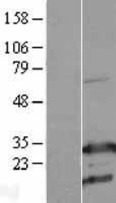 Western Blot: RhoGDI Overexpression Lysate (Adult Normal) [NBL1-07673] Left-Empty vector transfected control cell lysate (HEK293 cell lysate); Right -Over-expression Lysate for RhoGDI.
