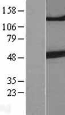 Western Blot: Tubulin Beta 3 Overexpression Lysate (Adult Normal) [NBL1-17440] Left-Empty vector transfected control cell lysate (HEK293 cell lysate); Right -Over-expression Lysate for Tubulin Beta 3.