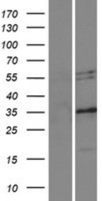 Western Blot: Nogo Overexpression Lysate (Adult Normal) [NBP2-11269] Left-Empty vector transfected control cell lysate (HEK293 cell lysate); Right -Over-expression Lysate for Nogo.