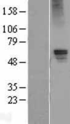 Western Blot: GABA A Receptor alpha 5 Overexpression Lysate (Adult Normal) [NBP2-11482] Left-Empty vector transfected control cell lysate (HEK293 cell lysate); Right -Over-expression Lysate for GABA A Receptor alpha 5.