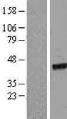 Western Blot: EIF2 beta Overexpression Lysate (Adult Normal) [NBL1-10187] Left-Empty vector transfected control cell lysate (HEK293 cell lysate); Right -Over-expression Lysate for EIF2 beta.