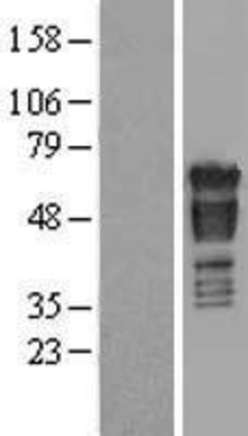 Western Blot: PAK4 Overexpression Lysate (Adult Normal) [NBL1-14080] Left-Empty vector transfected control cell lysate (HEK293 cell lysate); Right -Over-expression Lysate for PAK4.