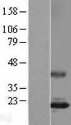 Western Blot: IL17 Overexpression Lysate (Adult Normal) [NBL1-11912] Left-Empty vector transfected control cell lysate (HEK293 cell lysate); Right -Over-expression Lysate for IL17.