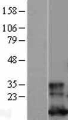 Western Blot: Glutaredoxin 1 Overexpression Lysate (Adult Normal) [NBP2-11401] Left-Empty vector transfected control cell lysate (HEK293 cell lysate); Right -Over-expression Lysate for Glutaredoxin 1.