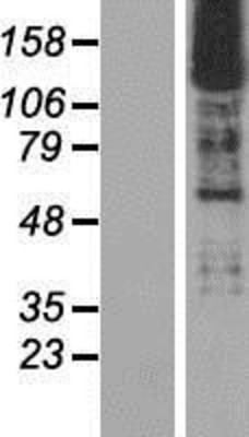 Western Blot: SMARCC2/BAF170 Overexpression Lysate (Adult Normal) [NBP2-11321] Left-Empty vector transfected control cell lysate (HEK293 cell lysate); Right -Over-expression Lysate for SMARCC2/BAF170.
