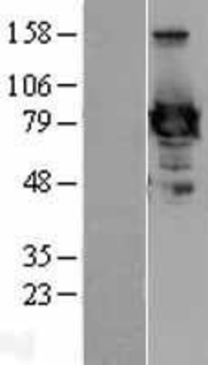 Western Blot: Ezrin Overexpression Lysate (Adult Normal) [NBP2-11418] Left-Empty vector transfected control cell lysate (HEK293 cell lysate); Right -Over-expression Lysate for Ezrin.