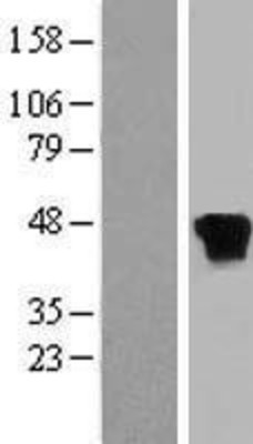 Western Blot: RP2 Overexpression Lysate (Adult Normal) [NBL1-15486] Left-Empty vector transfected control cell lysate (HEK293 cell lysate); Right -Over-expression Lysate for RP2.
