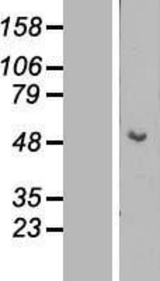 Western Blot: Cytokeratin 15 Overexpression Lysate (Adult Normal) [NBL1-12382] Left-Empty vector transfected control cell lysate (HEK293 cell lysate); Right -Over-expression Lysate for Cytokeratin 15.