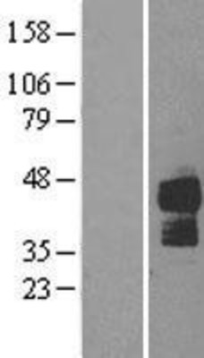 Western Blot: TRAIL-R2 Overexpression Lysate (Adult Normal) [NBL1-17142] Left-Empty vector transfected control cell lysate (HEK293 cell lysate); Right -Over-expression Lysate for TRAIL-R2.