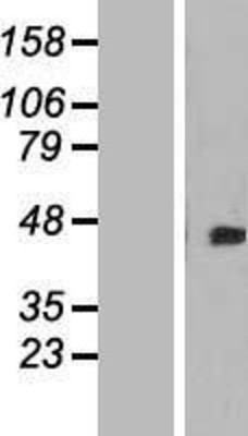 Western Blot: DOK4 Overexpression Lysate (Adult Normal) [NBL1-09979] Left-Empty vector transfected control cell lysate (HEK293 cell lysate); Right -Over-expression Lysate for DOK4.