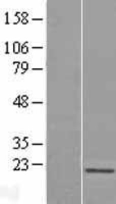 Western Blot: Skp1 Overexpression Lysate (Adult Normal) [NBL1-15994] Left-Empty vector transfected control cell lysate (HEK293 cell lysate); Right -Over-expression Lysate for Skp1.