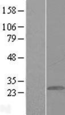 Western Blot: GCAP1 Overexpression Lysate (Adult Normal) [NBL1-11406] - Western Blot experiments.  Left-Control; Right -Over-expression Lysate for GUCA1A