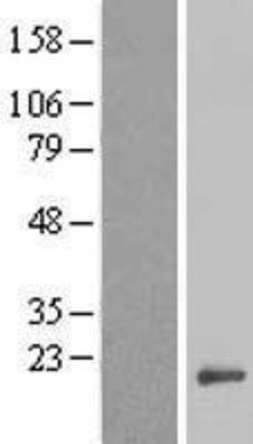 Western Blot: C11orf51 Overexpression Lysate (Adult Normal) [NBL1-08107] Left-Empty vector transfected control cell lysate (HEK293 cell lysate); Right -Over-expression Lysate for C11orf51.
