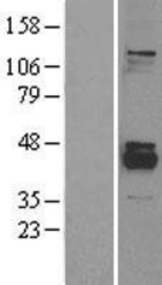 Western Blot: PPM1K Overexpression Lysate (Adult Normal) [NBL1-14665] Left-Empty vector transfected control cell lysate (HEK293 cell lysate); Right -Over-expression Lysate for PPM1K.