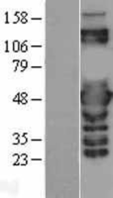 Western Blot: PSMC3 Overexpression Lysate (Adult Normal) [NBL1-14888] Left-Empty vector transfected control cell lysate (HEK293 cell lysate); Right -Over-expression Lysate for PSMC3.