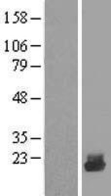 Western Blot: UBE2D4 Overexpression Lysate (Adult Normal) [NBL1-17523] Left-Empty vector transfected control cell lysate (HEK293 cell lysate); Right -Over-expression Lysate for UBE2D4.