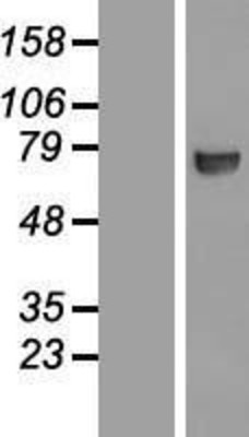 Western Blot: CTP synthase Overexpression Lysate (Adult Normal) [NBL1-09580] Left-Empty vector transfected control cell lysate (HEK293 cell lysate); Right -Over-expression Lysate for CTP synthase.