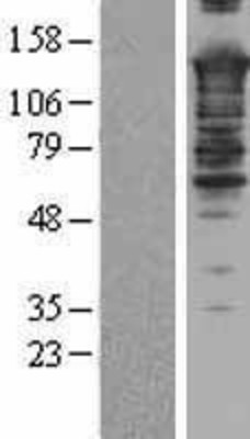 Western Blot: SMARCC2/BAF170 Overexpression Lysate (Adult Normal) [NBL1-16232] Left-Empty vector transfected control cell lysate (HEK293 cell lysate); Right -Over-expression Lysate for SMARCC2/BAF170.