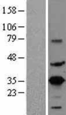 Western Blot: CREM Overexpression Lysate (Adult Normal) [NBL1-09473] Left-Empty vector transfected control cell lysate (HEK293 cell lysate); Right -Over-expression Lysate for CREM.