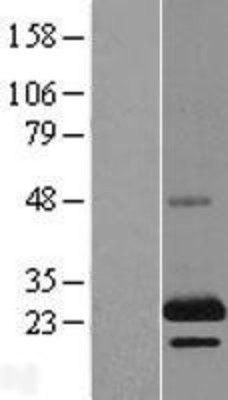Western Blot: TSSC3 Overexpression Lysate (Adult Normal) [NBL1-14368] Left-Empty vector transfected control cell lysate (HEK293 cell lysate); Right -Over-expression Lysate for TSSC3.