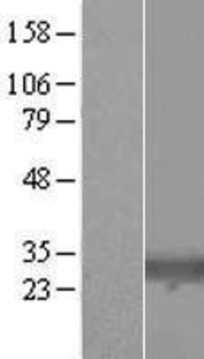 Western Blot: TIGAR Overexpression Lysate (Adult Normal) [NBL1-08147] Left-Empty vector transfected control cell lysate (HEK293 cell lysate); Right -Over-expression Lysate for TIGAR.