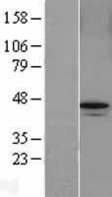 Western Blot: ABRO Overexpression Lysate (Adult Normal) [NBL1-10501] Left-Empty vector transfected control cell lysate (HEK293 cell lysate); Right -Over-expression Lysate for ABRO.