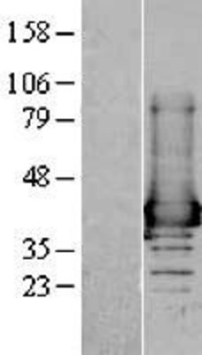 Western Blot: AKR1A1 Overexpression Lysate (Adult Normal) [NBL1-07432] Left-Empty vector transfected control cell lysate (HEK293 cell lysate); Right -Over-expression Lysate for AKR1A1.