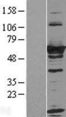 Western Blot: RTKN Overexpression Lysate (Adult Normal) [NBL1-15609] Left-Empty vector transfected control cell lysate (HEK293 cell lysate); Right -Over-expression Lysate for RTKN.