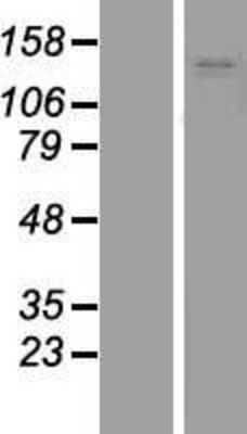 Western Blot: MYBPC1 Overexpression Lysate (Adult Normal) [NBP2-04537] Left-Empty vector transfected control cell lysate (HEK293 cell lysate); Right -Over-expression Lysate for MYBPC1.