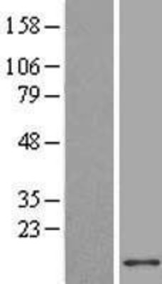 Western Blot: ACBD7 Overexpression Lysate (Adult Normal) [NBL1-07229] Left-Empty vector transfected control cell lysate (HEK293 cell lysate); Right -Over-expression Lysate for ACBD7.