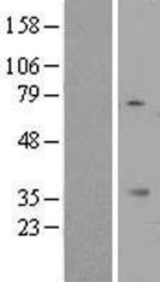 Western Blot: MIOX Overexpression Lysate (Adult Normal) [NBL1-13114] Left-Empty vector transfected control cell lysate (HEK293 cell lysate); Right -Over-expression Lysate for MIOX.