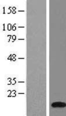 Western Blot: ATP6V1G1 Overexpression Lysate (Adult Normal) [NBL1-07846] Left-Empty vector transfected control cell lysate (HEK293 cell lysate); Right -Over-expression Lysate for ATP6V1G1.