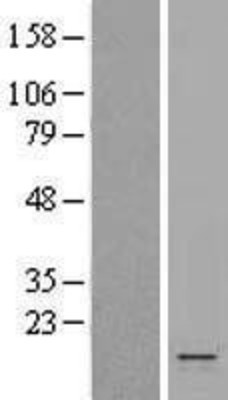 Western Blot: KCNE1 Overexpression Lysate (Adult Normal) [NBP2-09458] Left-Empty vector transfected control cell lysate (HEK293 cell lysate); Right -Over-expression Lysate for KCNE1.
