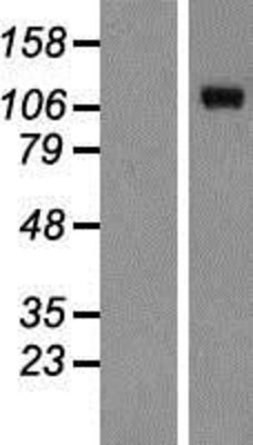 Western Blot: SERCA2 ATPase Overexpression Lysate (Adult Normal) [NBP2-05184] Left-Empty vector transfected control cell lysate (HEK293 cell lysate); Right -Over-expression Lysate for SERCA2 ATPase.