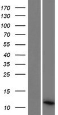 Western Blot: PCOTH Overexpression Lysate (Adult Normal) [NBP2-09587] Left-Empty vector transfected control cell lysate (HEK293 cell lysate); Right -Over-expression Lysate for PCOTH.