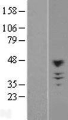 Western Blot: CHST10 Overexpression Lysate (Adult Normal) [NBL1-09192] Left-Empty vector transfected control cell lysate (HEK293 cell lysate); Right -Over-expression Lysate for CHST10.