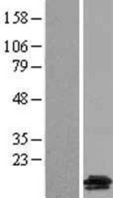 Western Blot: GALP Overexpression Lysate (Adult Normal) [NBL1-10961] Left-Empty vector transfected control cell lysate (HEK293 cell lysate); Right -Over-expression Lysate for GALP.