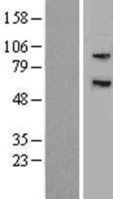 Western Blot: MYLK3 Overexpression Lysate (Adult Normal) [NBP2-04857] Left-Empty vector transfected control cell lysate (HEK293 cell lysate); Right -Over-expression Lysate for MYLK3.
