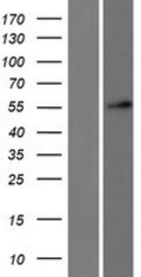 Western Blot: DKC1 Overexpression Lysate (Adult Normal) [NBP2-09647] Left-Empty vector transfected control cell lysate (HEK293 cell lysate); Right -Over-expression Lysate for DKC1.