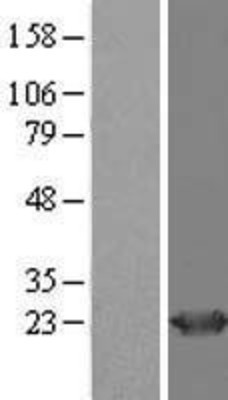 Western Blot: HD domain containing 2 Overexpression Lysate (Adult Normal) [NBL1-11487] Left-Empty vector transfected control cell lysate (HEK293 cell lysate); Right -Over-expression Lysate for HD domain containing 2.