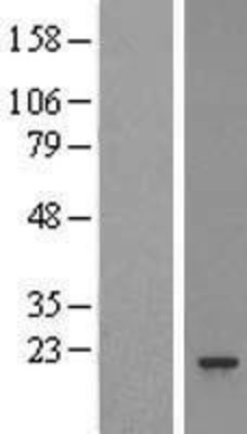 Western Blot: Proteasome 20S beta 3 Overexpression Lysate (Adult Normal) [NBL1-14878] Left-Empty vector transfected control cell lysate (HEK293 cell lysate); Right -Over-expression Lysate for Proteasome 20S beta 3.