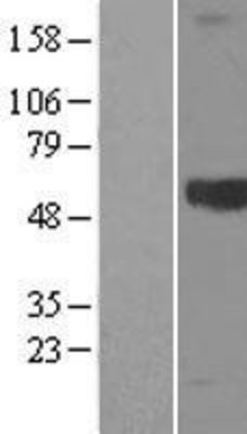 Western Blot: HMW Kininogen Overexpression Lysate (Adult Normal) [NBL1-12368] Left-Empty vector transfected control cell lysate (HEK293 cell lysate); Right -Over-expression Lysate for HMW Kininogen.