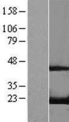 Western Blot: RFK Overexpression Lysate (Adult Normal) [NBL1-15297] Left-Empty vector transfected control cell lysate (HEK293 cell lysate); Right -Over-expression Lysate for RFK.